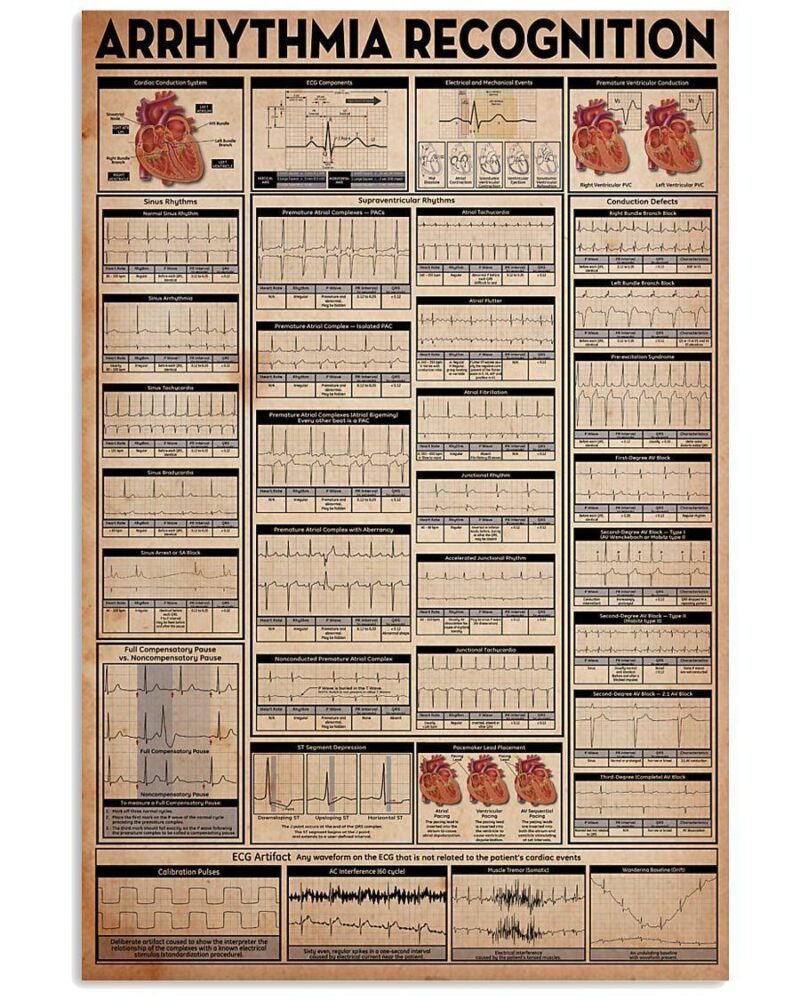 Nurse Arrhythmia Recognition Poster Vertical Poster Canvas Wall Decor Visual Art 1